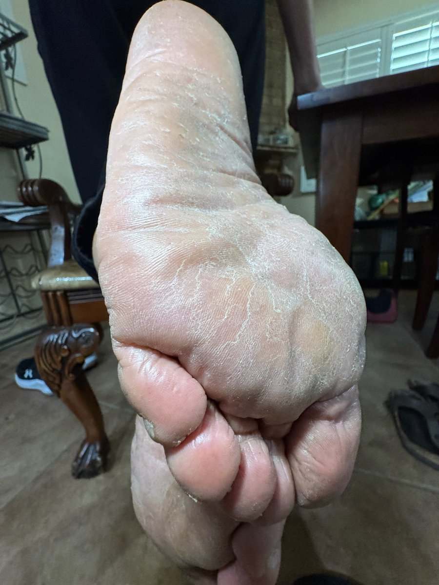 THE STINKY👣 QUEEN Sz11 tweet media