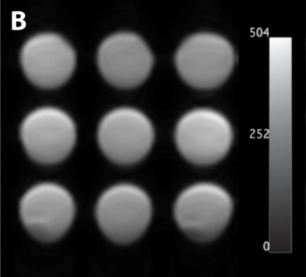 Bioeng_MDPI's tweet photo. 💥Excited for the publication: "Microwave-Assisted Optimization of Polyvinyl Alcohol Cryogel (PVA-C) Manufacturing for MRI Phantom Production"
🔗https://t.co/yGwQTA6qPe
📌 #BiomedicalEngineering #MRI #PhantomModels #PVAcryogel  #Microwaves #Bioengineering #MedicalImaging https://t.co/1gVxgi40ca