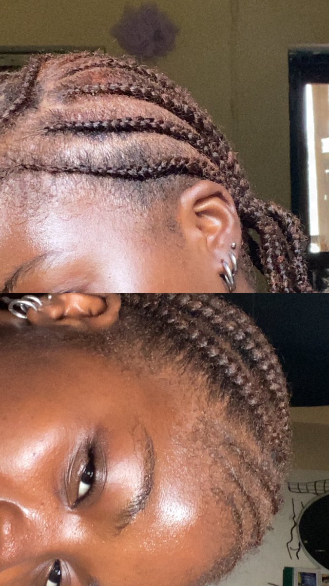 forgot to show you guys my third ear too🙂‍↔️😝