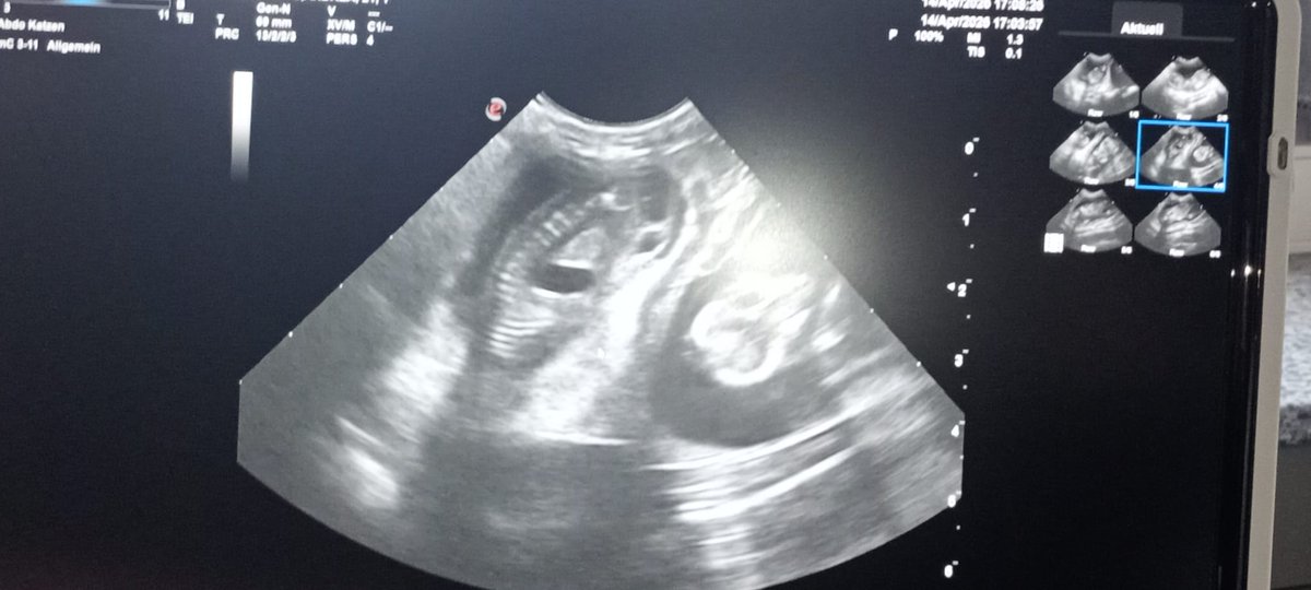 𝕆𝕝𝕕 𝕊𝕔𝕙𝕒𝕖𝕥𝕥𝕖𝕣𝕙𝕒𝕖𝕟𝕕𝕝𝕖 🥊🎱🏓🏍 tweet media