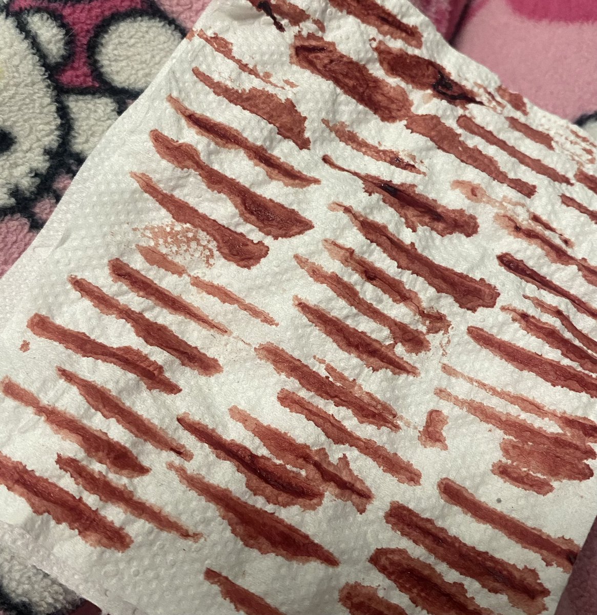 isabella / rag doll of shedtwt 🪽 tweet media