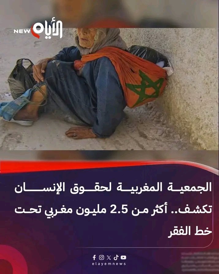 sandra55669's tweet photo. @j_jalalee علاه راك تبكي القرد السنغولي المذلول واش العبودية لي راك فيها لسقها في سيادكم ههه شكون راهي تشرد فيهم الصهاينة وانفجار الرباط 15 قتيل واكثر من 30 مصاب هذا مشي ذل لي راك فيه خياتكم بغلات إسبانيا وبونيشات الخليج هذاك مشي ذل ههه مصنفين اكثر شعب مذلول ومازال تحت العبودية https://t.co/pgcETudwif