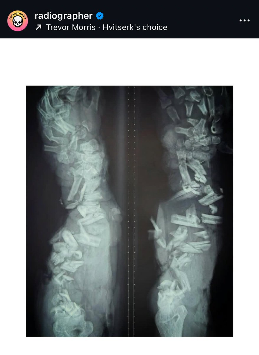 Iza🩺🍋Ferretto:🏷️CALOURADEMEDICINA tweet media