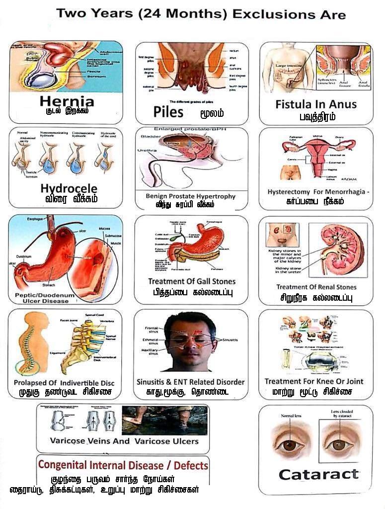 Kbe_ins's tweet image. Specified Diseases Waiting Period of 2 Years applicable in all health insurance policies of every insurance company. 

Pls find 3 presentations but same contents. #HealthInsurance #Claim #MedicalInsurance