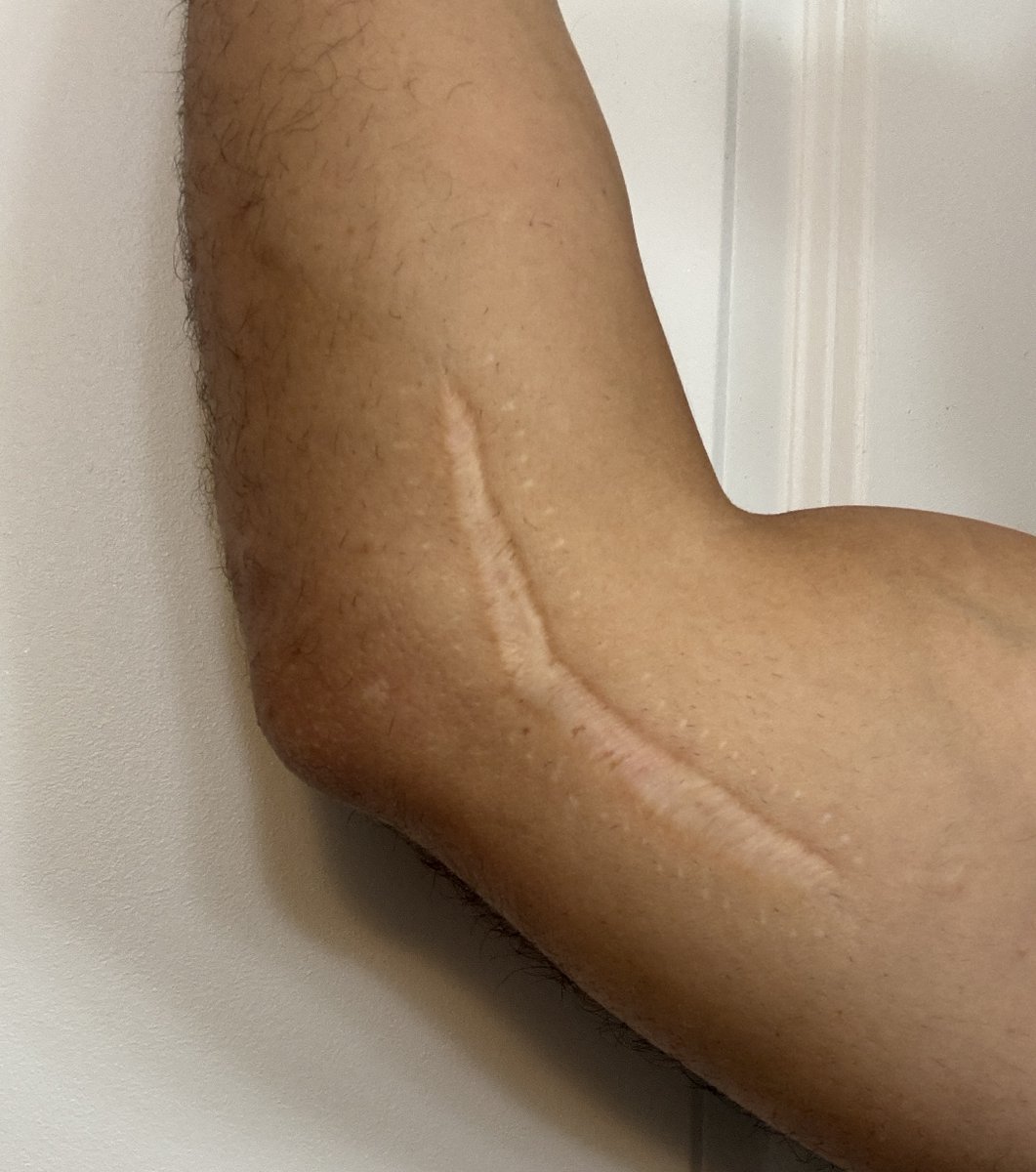 Matt Moody tweet media