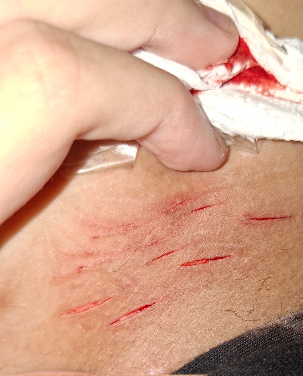 Shuriken of shtwt tweet media