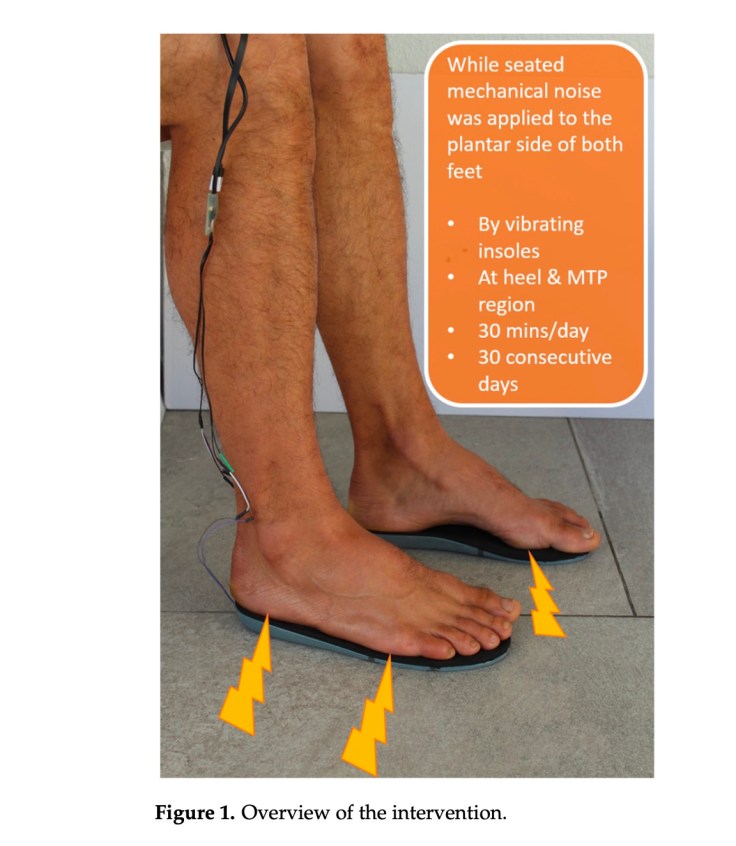 DGArmstrong's tweet image. More good vibrations? Retention of Improved Plantar Sensation with Vibrating Insoles in Diabetic Neuropathy Patients #Neuromodulation #ActAgainstAmputation #DiabeticFoot diabeticfootonline.com/2024/05/26/mor…