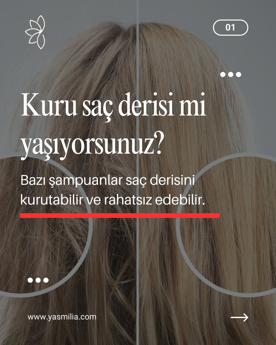 YasmiliaOfc's tweet photo. Daha nazik bir temizlik sunan formüller, saç ve saç derisinin doğal dengesini korumaya destek olur. Yasmilia Doğal Şampuan, saçınızı nazikçe temizlemeye yardımcı olurken daha yumuşak, ferah ve dengeli bir his sunmayı hedefler. 🌿
#Yasmilia #DoğalŞampuan #SaçBakımı #KuruSaçDerisi https://t.co/XIV70qQtM4