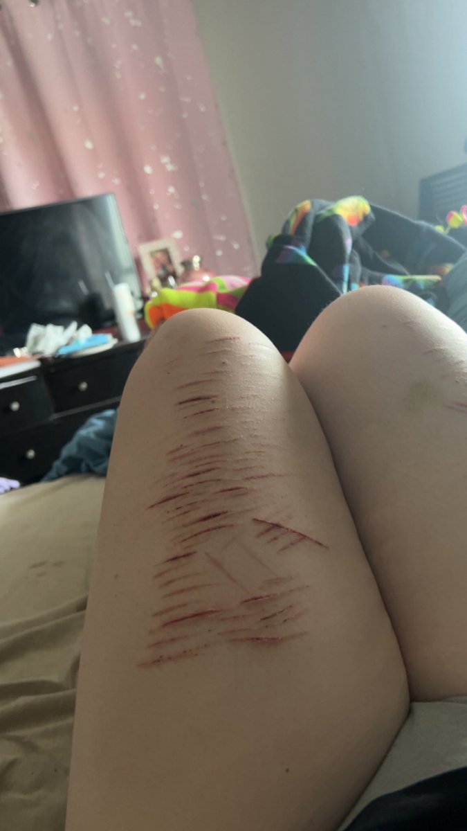 rainbowdash of shedtwt tweet media