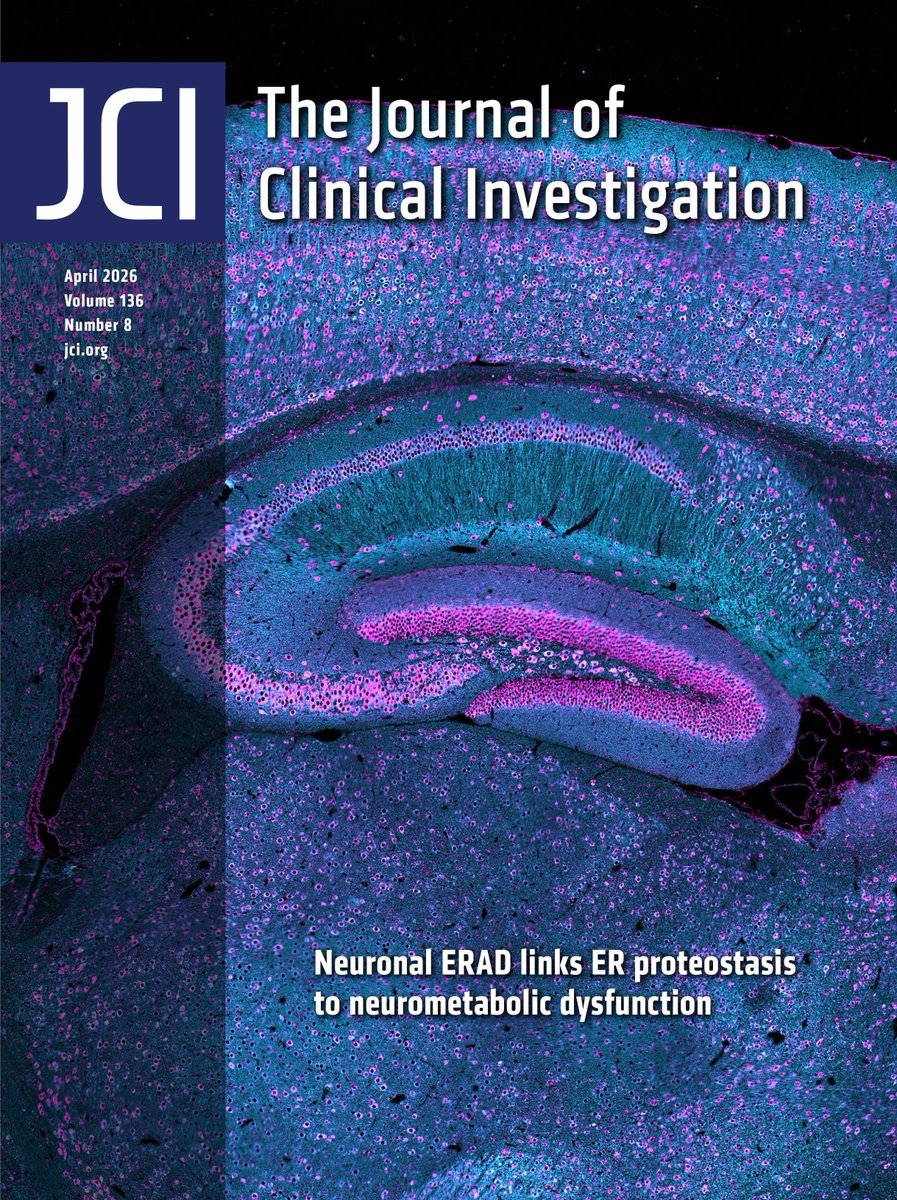 jclinicalinvest's tweet photo. This issue’s Cover highlights the molecular basis of endoplasmic reticulum–associated degradation (ERAD)-related neurodevelopmental disease: https://t.co/hIjqbso9m2

Ling Qi & team @MedicineUVA reveal disruption of ERAD in neurons, through conditional deletion of the ER membrane protein SEL1L, impairs motor function and reduces survival in mice. 

The cover image shows immunofluorescence staining of the ER-resident chaperone marker KDEL (magenta) and the neuronal marker MAP2 (cyan) in a coronal brain section from a neuron-specific Sel1L knockout mouse.