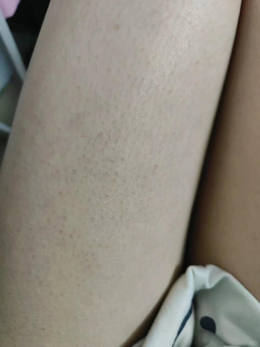 Antonia ziza tweet media