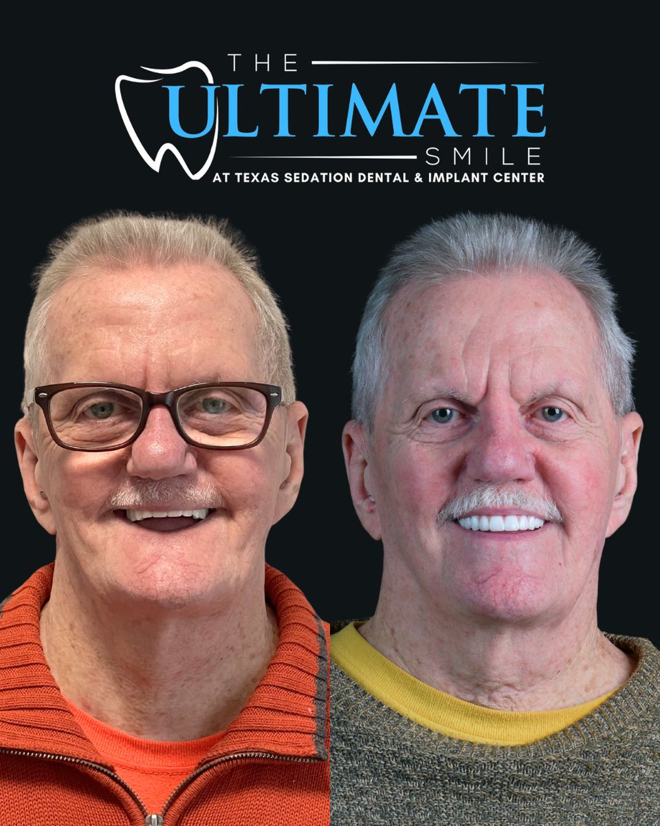 TXSedationDent's tweet image. Your new smile journey starts with one simple step ➡️  Send us a DM to schedule your complimentary Ultimate Smile Assessment today.

#DentalImplants #SmileTransformation #ZirconiaImplants #TeethImplants #NewSmile