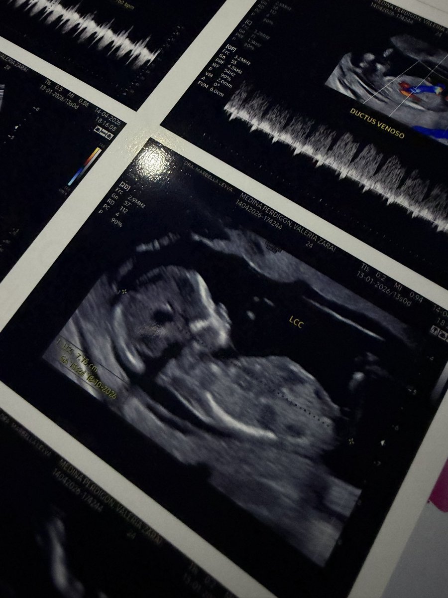 ValeMperd's tweet photo. Mi bebito hermoso 🥺😍 https://t.co/FZAYGwrzE5