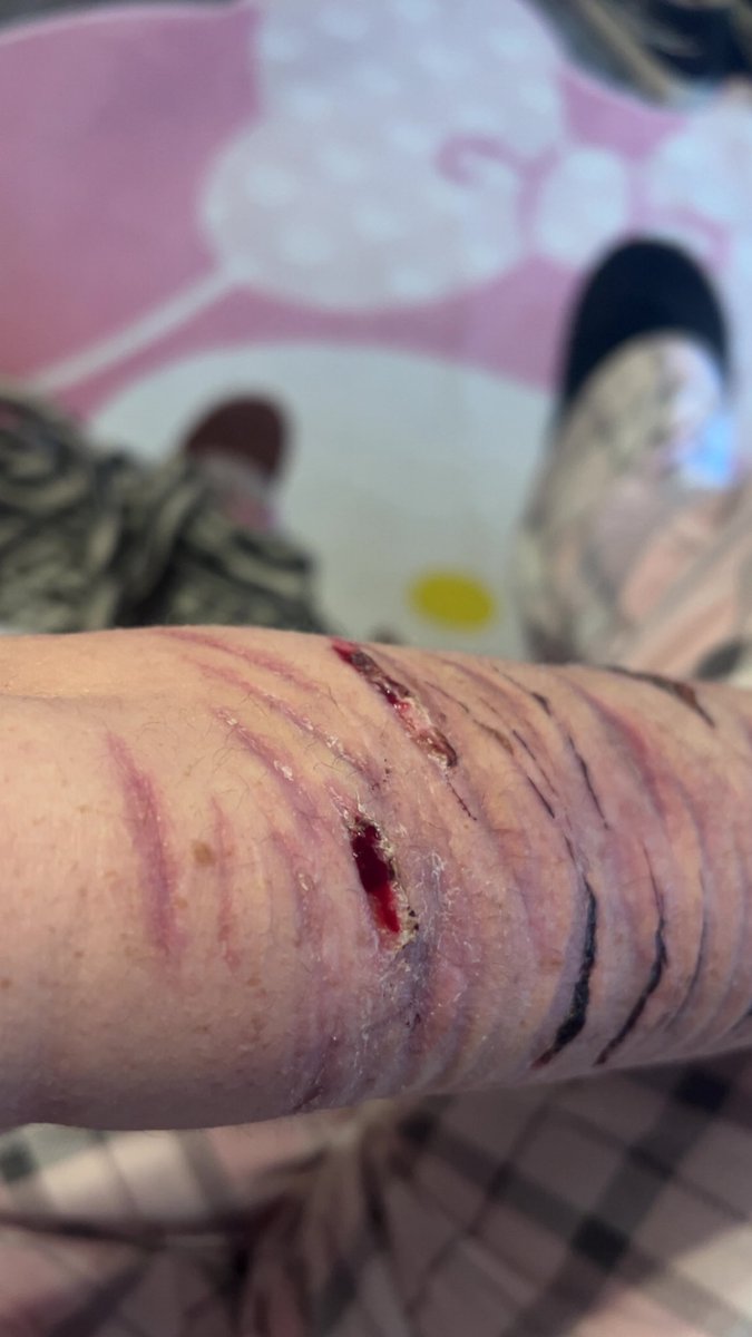 𝖋𝖗𝖊𝖞𝖆🧟‍♀️🎀 𝖘𝖍𝖊𝖉𝖙𝖜𝖙 tweet media