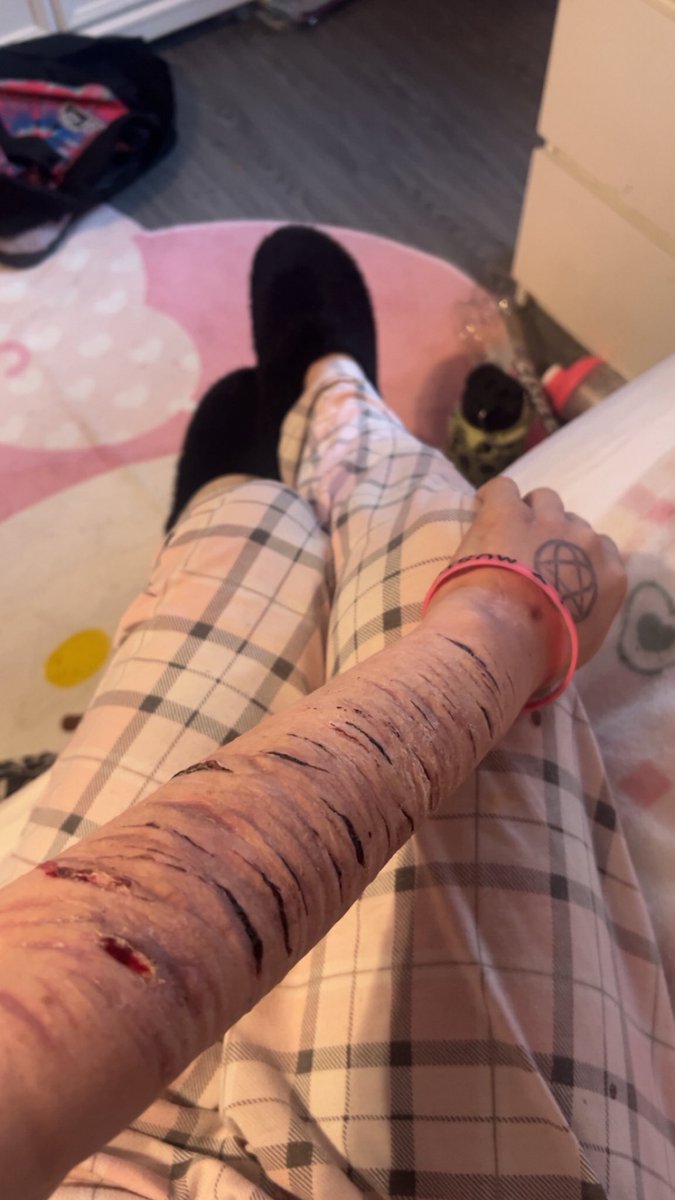 𝖋𝖗𝖊𝖞𝖆🧟‍♀️🎀 𝖘𝖍𝖊𝖉𝖙𝖜𝖙 tweet media