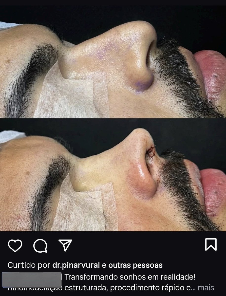 BarbieVisão 📺 tweet media