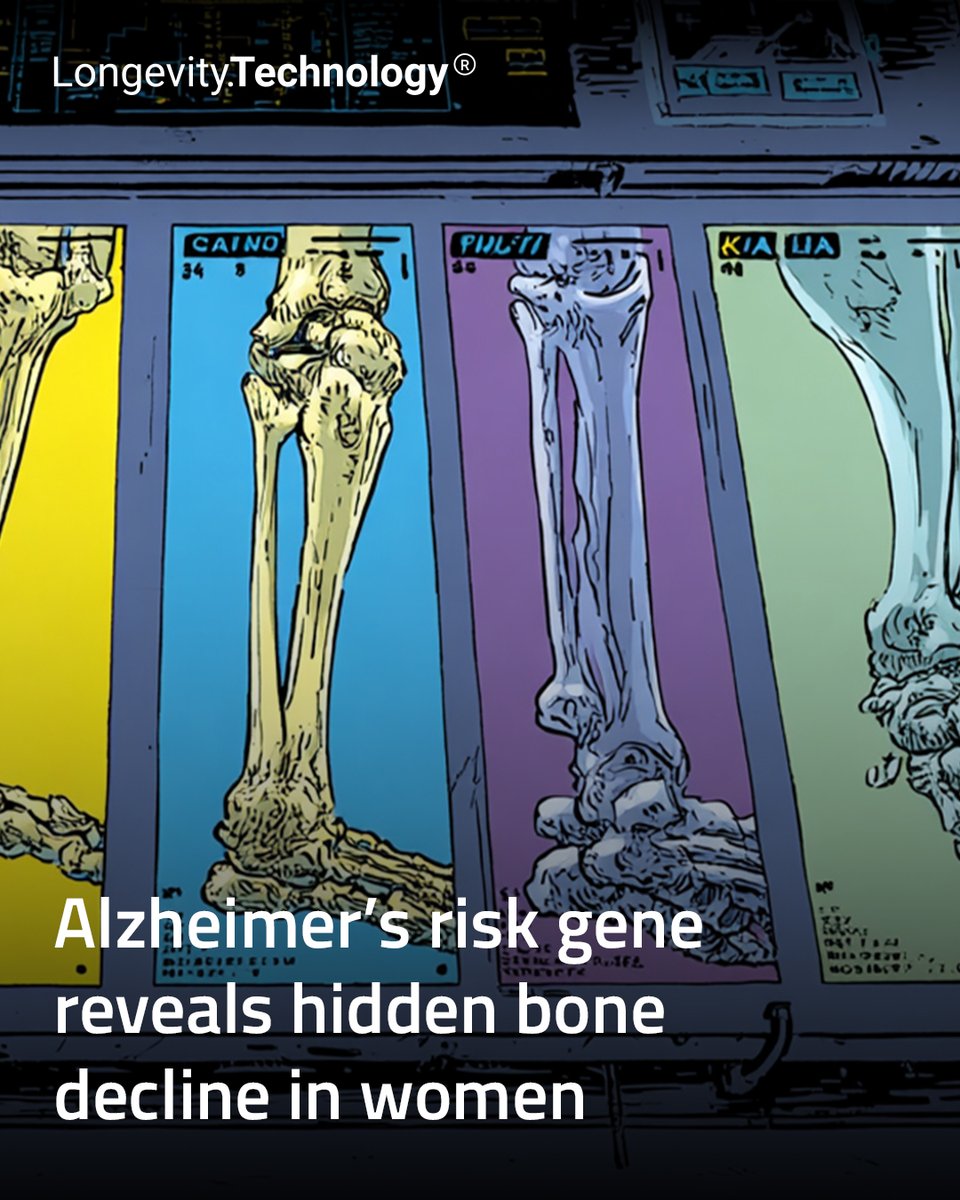 LongevityTech's tweet image. Alzheimer’s risk gene linked to hidden bone decline in women, revealing how neurodegeneration may begin beyond the brain.
ㅤ
Link in bio.
ㅤ
#longevity #alzheimers #womenshealth #healthspan #biotech