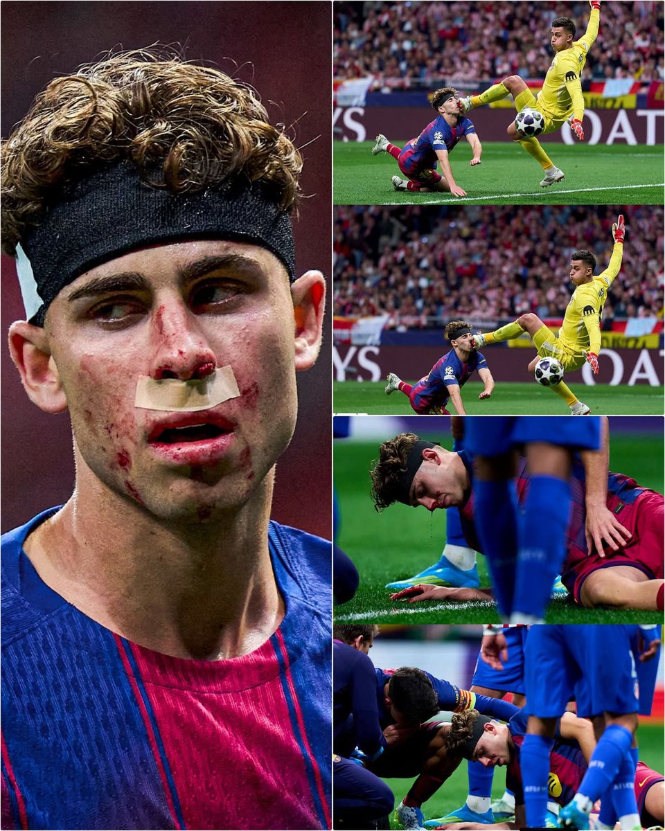 Mucho honor a Fermín López. 🤕🥹