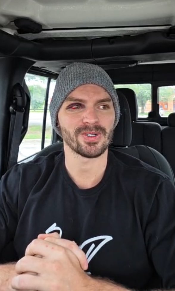 mDinarExtreme's tweet photo. James Drake just talked on his live stream Insta vid that he plans on becoming a streamer 

Damn so he realized that acting isn’t his thing?

Good luck streaming to 13 people, and please check your eye dude, it looks scary! 

#fishtanklive #fishtank #fishtankisntlive https://t.co/4MNmLBYhvw
