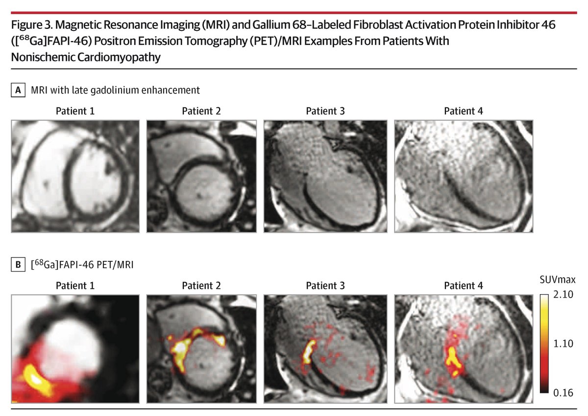 JAMA Cardiology tweet media