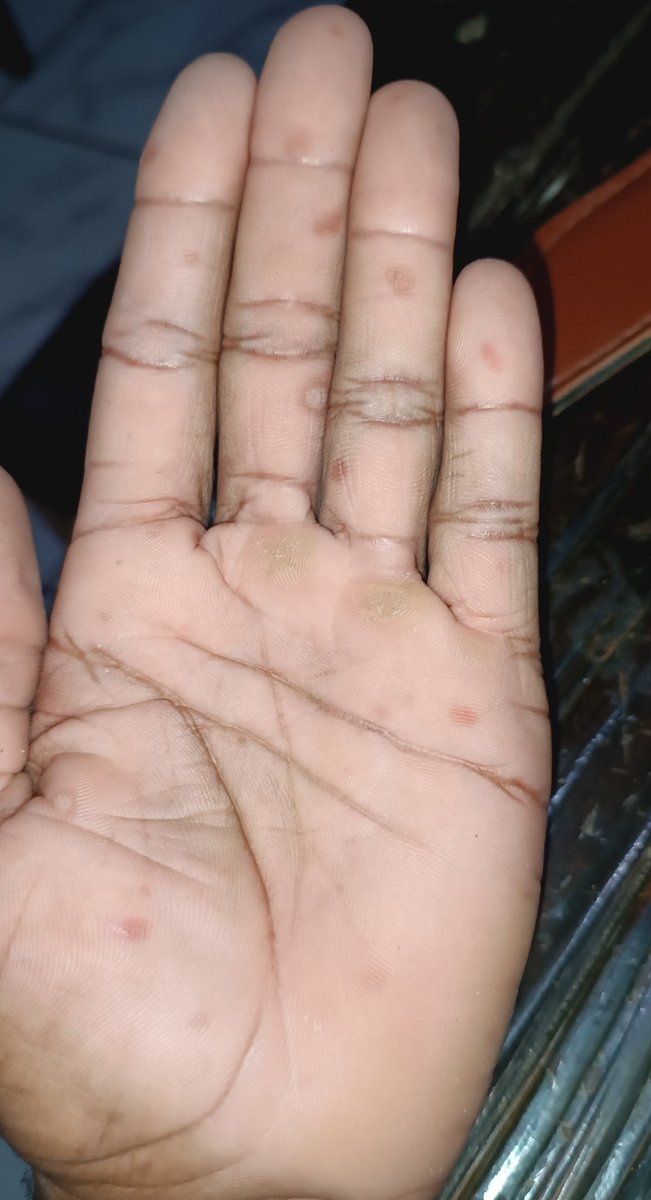 Lampião Matad0r de Ma€umbeir0 Rebirth tweet media