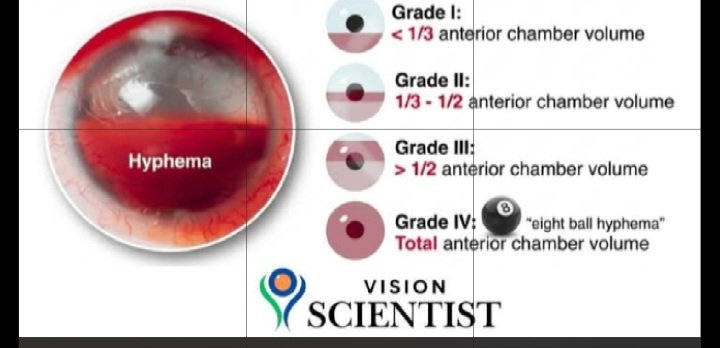 Drekvio's tweet image. Your #eye doesn't like #trauma 

Trauma through sharp objects, blow to the head and/or eyes, whether primed and/or acciental

By all means keep away from any/everything that leads to being hit in the eye

If for any reason you are involved in any eye/head trauma,