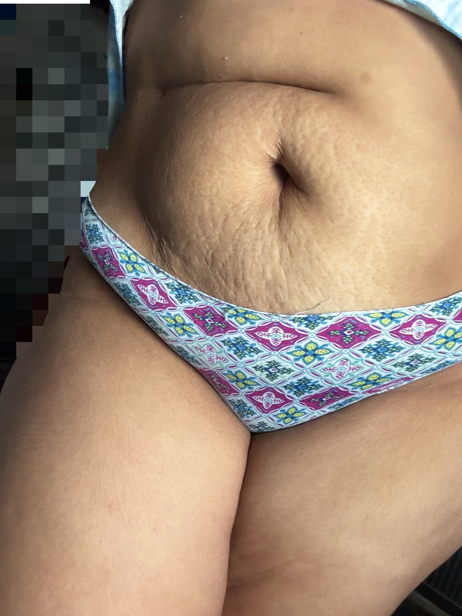 Josfollar tweet media