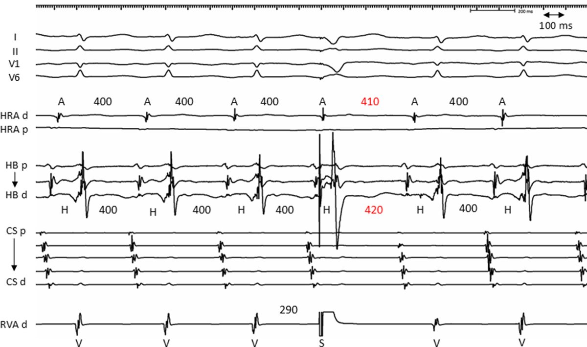 HeartRhythm tweet media