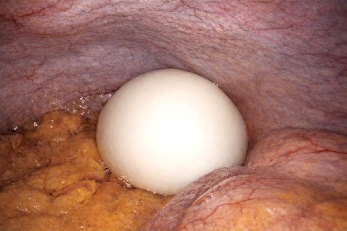 Keith Siau tweet media