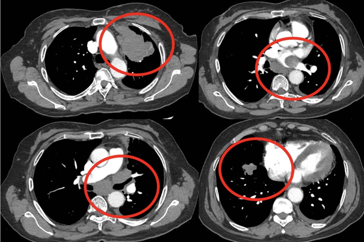 Balazs Halmos tweet media