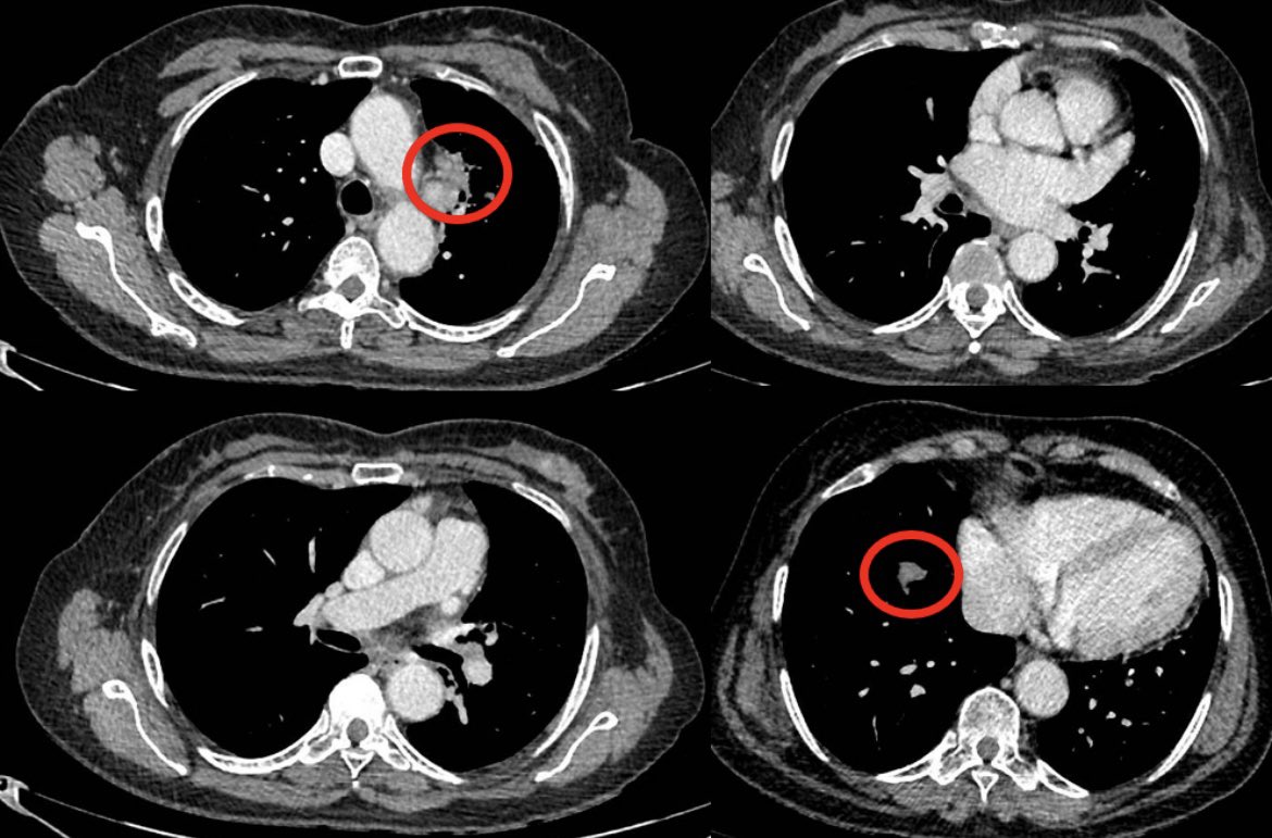 Balazs Halmos tweet media