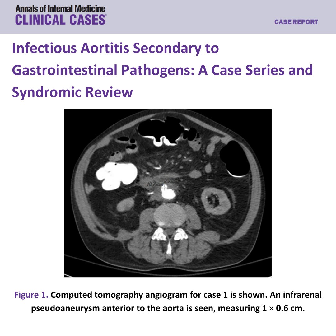 Annals of Internal Medicine: Clinical Cases tweet media