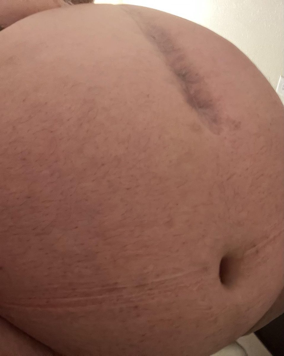 Romfat2 fit tweet media