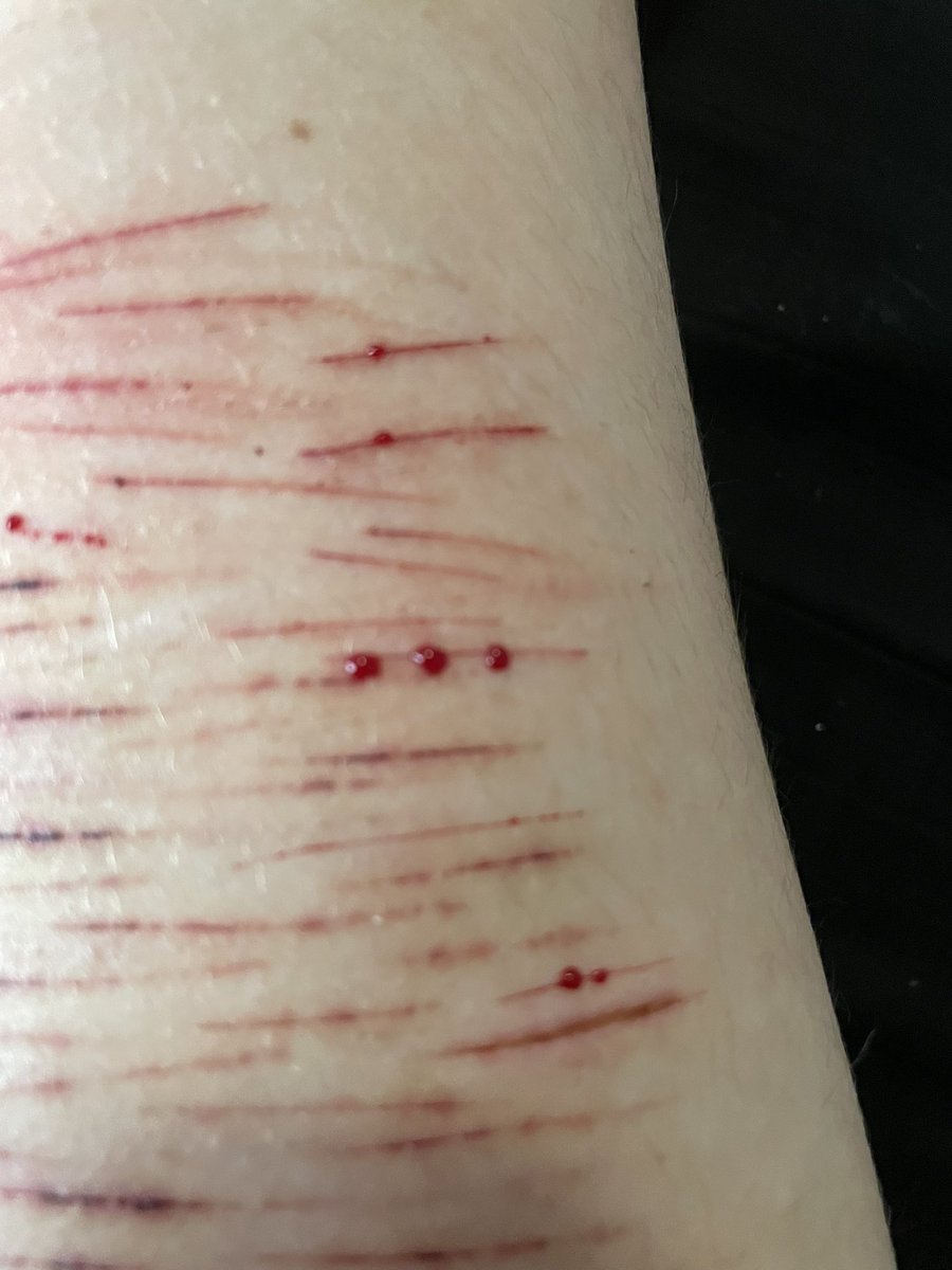 ◟♯ 🍮. / purin of shedtwt☀️ . ! tweet media