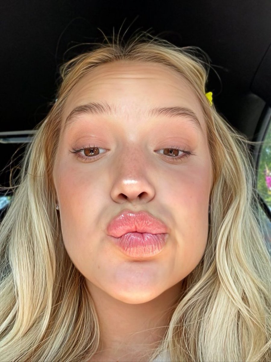 Faces & Tummies tweet media