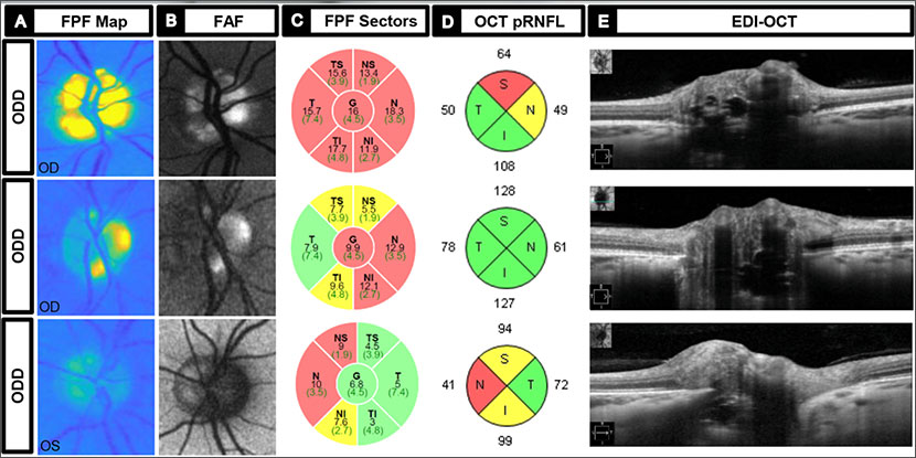 American Academy of Ophthalmology tweet media