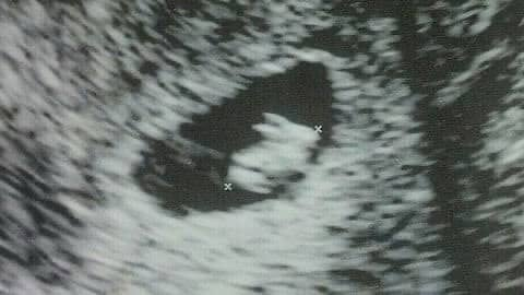 SanezVT💜🎰 tweet media