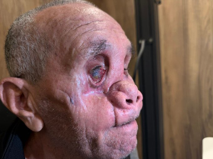 Abdullah Omar🇵🇸 tweet media