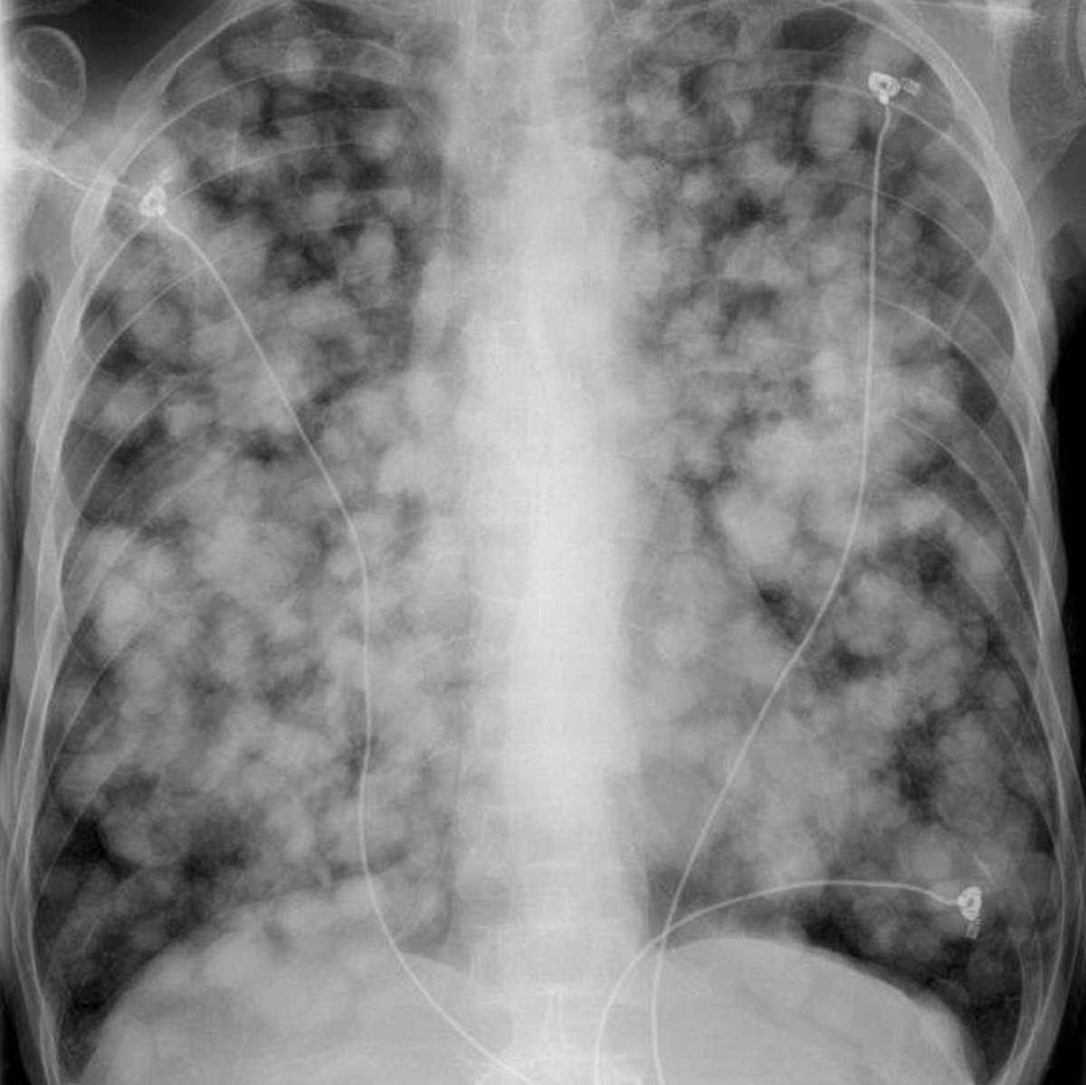 Dr. Nikhil Agrawal tweet media