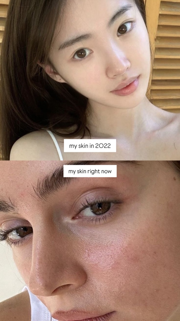 ✨OMBB | 🚫NO LINK tweet media