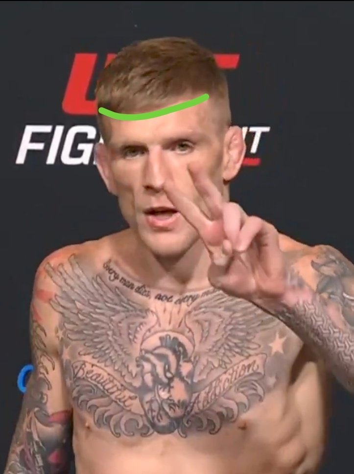 Renato Money Acriano tweet media