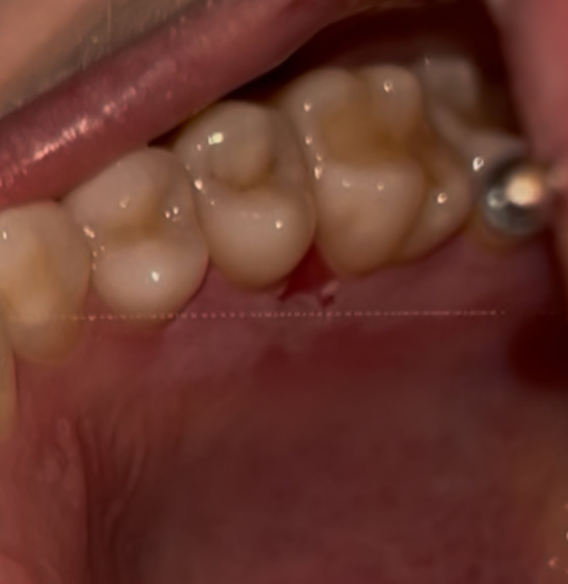 ⋆°‧ westley ·｡‧ b/p recovery tweet media