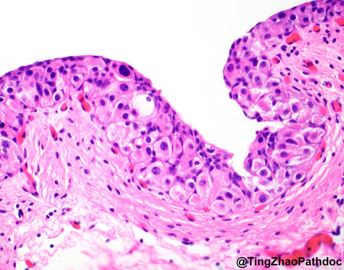 Ting Zhao, MD tweet media