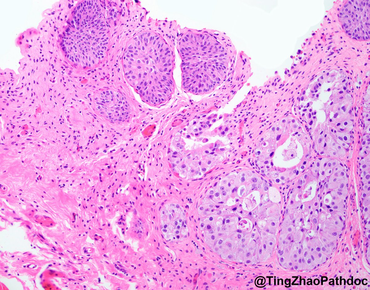 Ting Zhao, MD tweet media