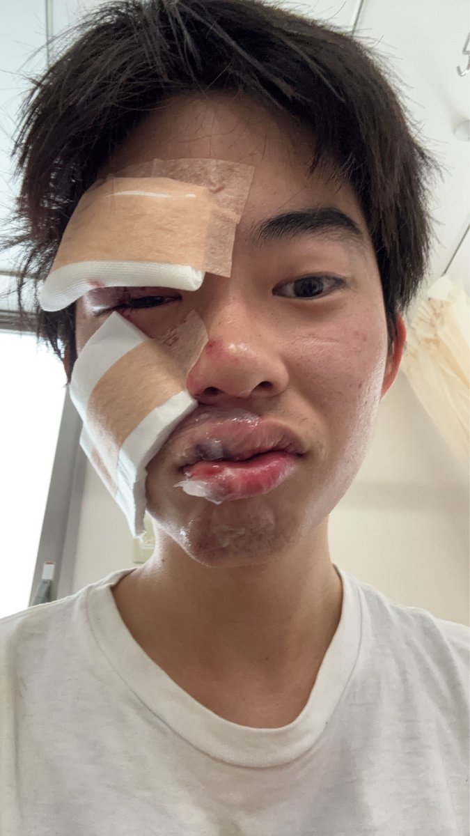 たけの〜こ tweet media