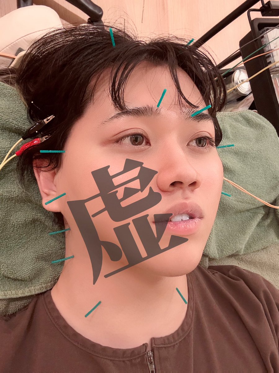 本日、笑っちゃうくらいに声出ない
(笑えない)(申し訳ない)(雨すごい)(おしり)
のだけど、今日は本気で遊びに来たので
喉も雨もあんたらもブッ飛ばすつもりで
やりますDEAD POP。
めちゃくちゃ楽しみなだけに悔しい。
昨日からやれるだけの事はやりました。
ぶつけます。受け取って返してや。
⚡🧠🔌⚡️