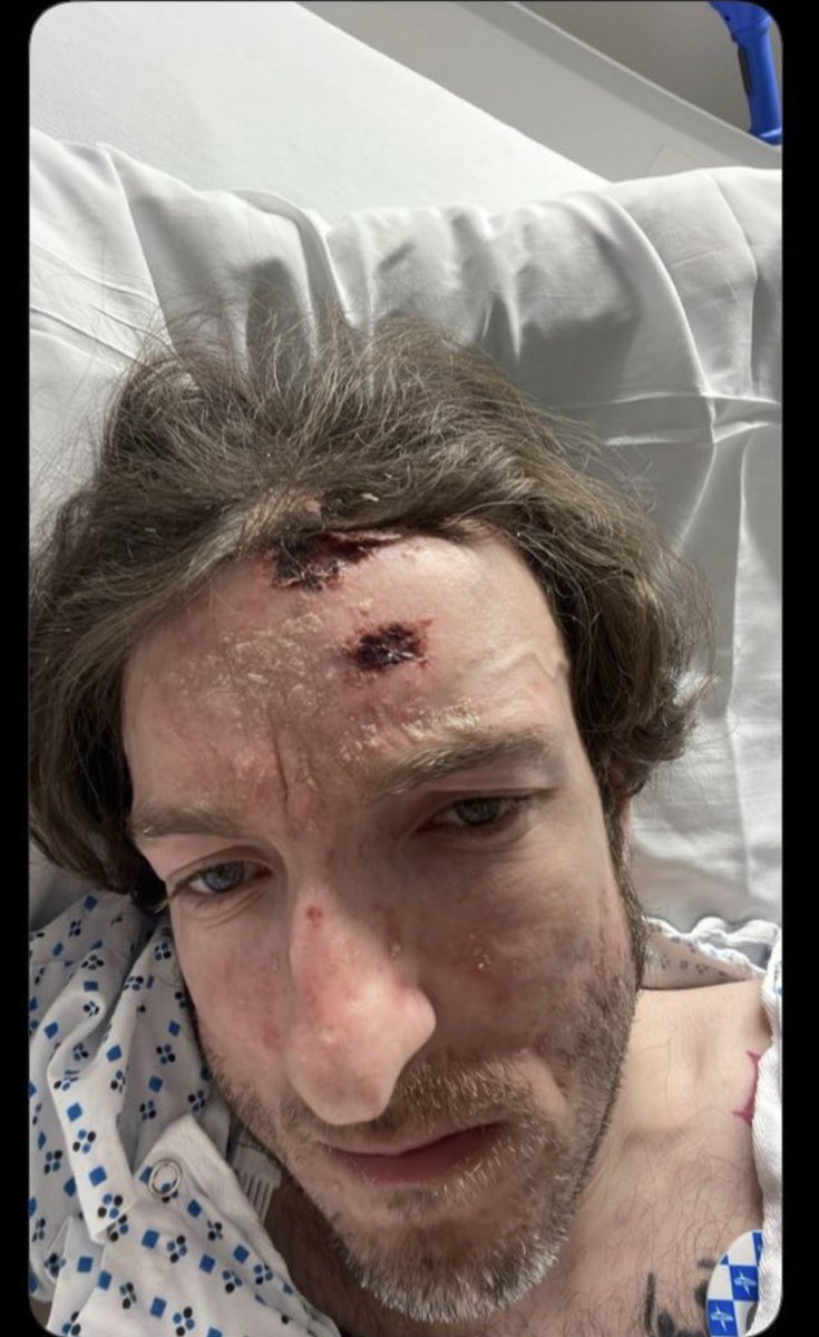 thetribalghost's tweet photo. 😭😭😭 HE GOT FUCKED UP. FAFO. https://t.co/wfUXCladXH