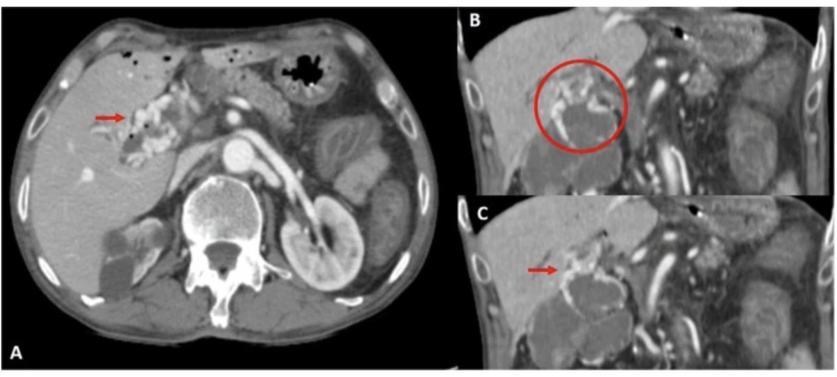 Indian Journal of Gastroenterology tweet media