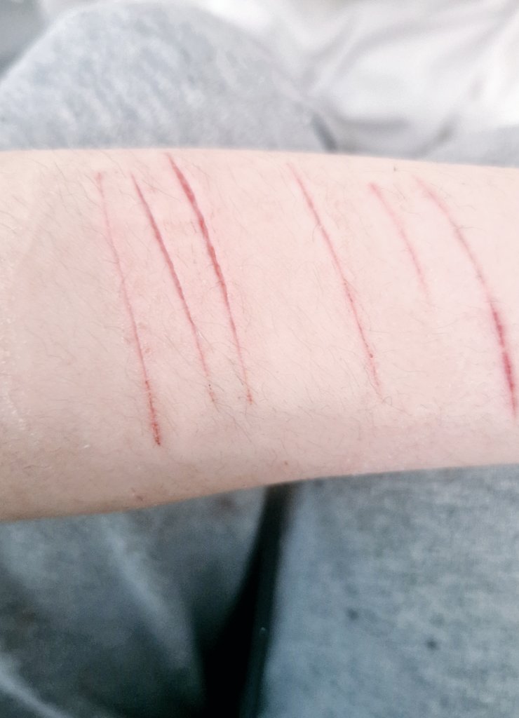 ⦻ ɴɪɴᴀ ᴛʜᴇ ᴋɪʟʟᴇʀ ᴏғ #sʜᴇᴅᴛᴡᴛ ⦻ tweet media