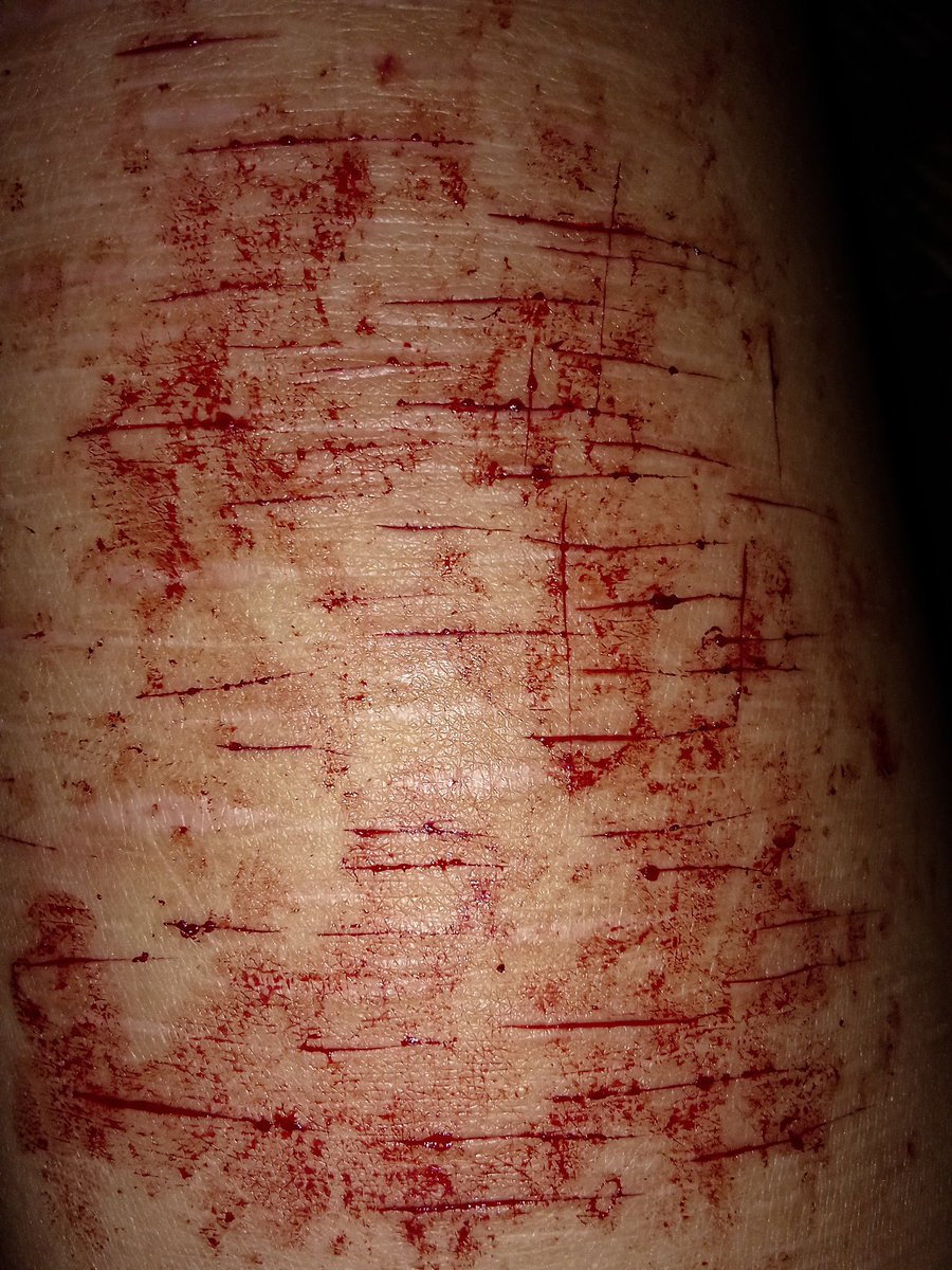 ⋆ conn. 🦇 tweet media